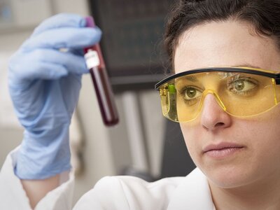 service-1-1 Lab technician checking a blood sample